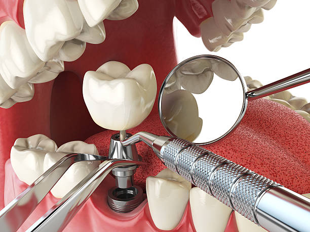 Best Emergency Root Canal Treatment in Elizabeth, NJ